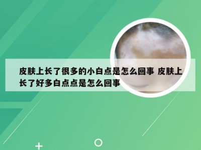 皮肤上长了很多的小白点是怎么回事 皮肤上长了好多白点点是怎么回事