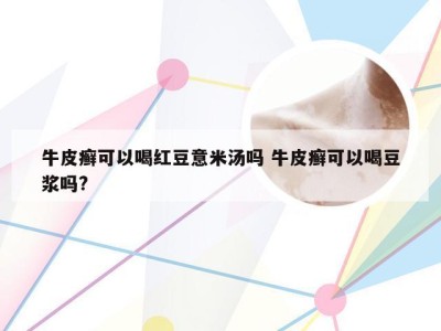 牛皮癣可以喝红豆意米汤吗 牛皮癣可以喝豆浆吗?