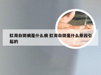 肛周白斑病是什么病 肛周白斑是什么原因引起的