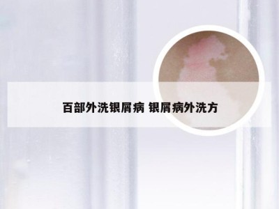 百部外洗银屑病 银屑病外洗方