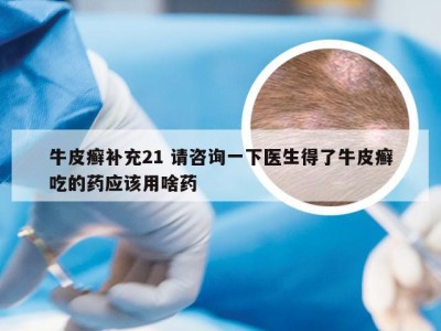 牛皮癣补充21 请咨询一下医生得了牛皮癣吃的药应该用啥药