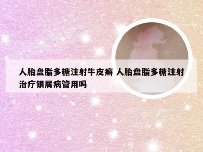 人胎盘脂多糖注射牛皮癣 人胎盘脂多糖注射治疗银屑病管用吗