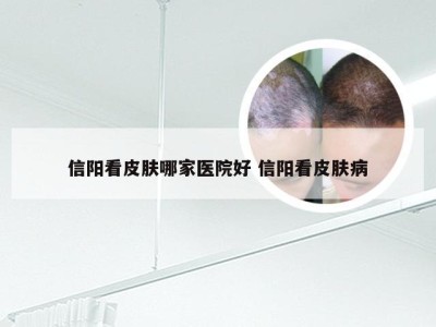 信阳看皮肤哪家医院好 信阳看皮肤病