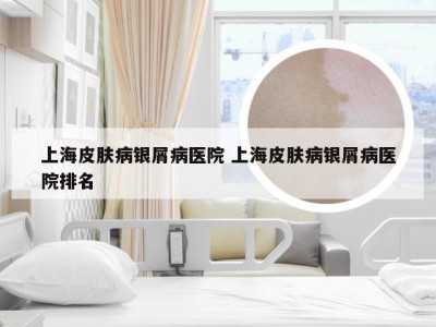上海皮肤病银屑病医院 上海皮肤病银屑病医院排名