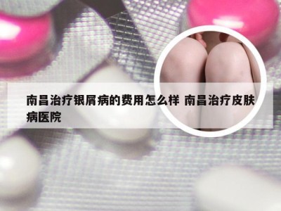 南昌治疗银屑病的费用怎么样 南昌治疗皮肤病医院