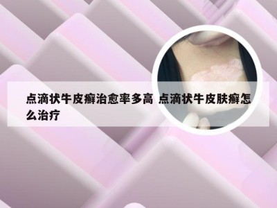 点滴状牛皮癣治愈率多高 点滴状牛皮肤癣怎么治疗