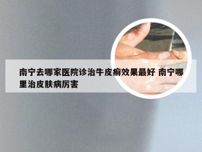 南宁去哪家医院诊治牛皮癣效果最好 南宁哪里治皮肤病厉害