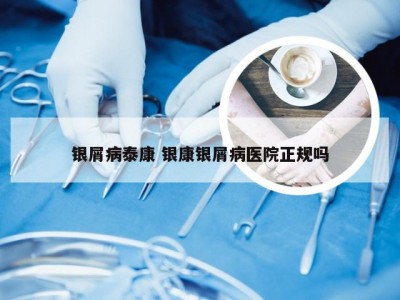 银屑病泰康 银康银屑病医院正规吗