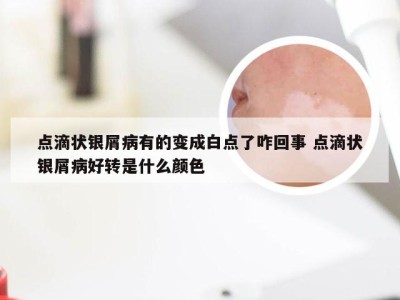 点滴状银屑病有的变成白点了咋回事 点滴状银屑病好转是什么颜色