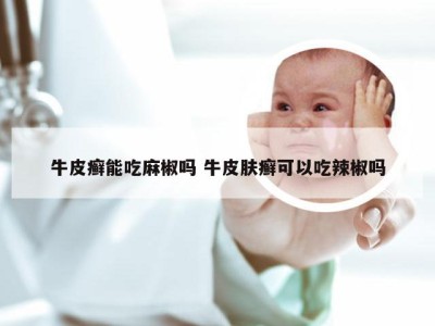 牛皮癣能吃麻椒吗 牛皮肤癣可以吃辣椒吗