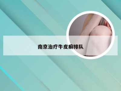 南京治疗牛皮癣排队