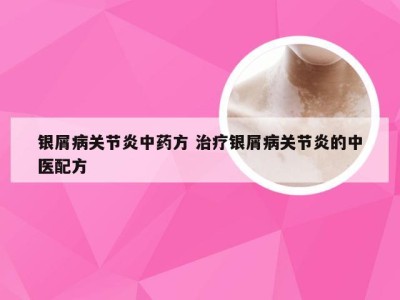 银屑病关节炎中药方 治疗银屑病关节炎的中医配方
