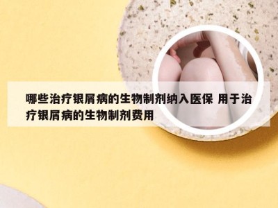 哪些治疗银屑病的生物制剂纳入医保 用于治疗银屑病的生物制剂费用