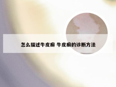 怎么描述牛皮癣 牛皮癣的诊断方法