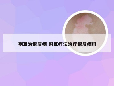 割耳治银屑病 割耳疗法治疗银屑病吗
