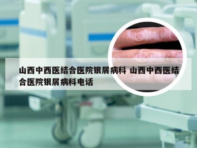山西中西医结合医院银屑病科 山西中西医结合医院银屑病科电话