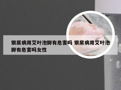 银屑病用艾叶泡脚有危害吗 银屑病用艾叶泡脚有危害吗女性