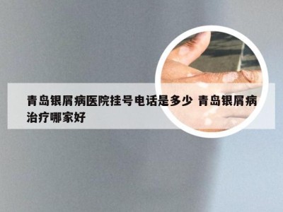 青岛银屑病医院挂号电话是多少 青岛银屑病治疗哪家好