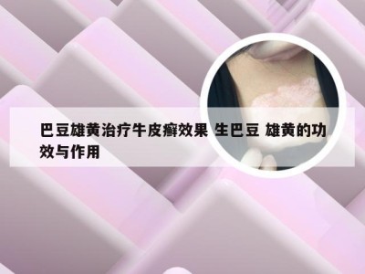 巴豆雄黄治疗牛皮癣效果 生巴豆 雄黄的功效与作用