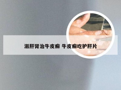 滋肝肾治牛皮癣 牛皮癣吃护肝片