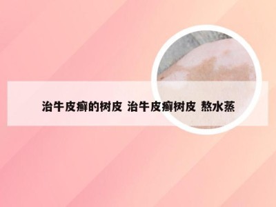 治牛皮癣的树皮 治牛皮癣树皮 熬水蒸