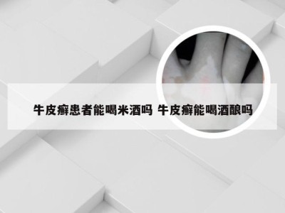 牛皮癣患者能喝米酒吗 牛皮癣能喝酒酿吗
