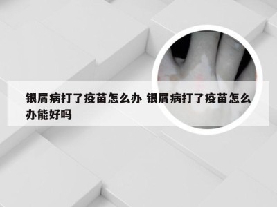 银屑病打了疫苗怎么办 银屑病打了疫苗怎么办能好吗