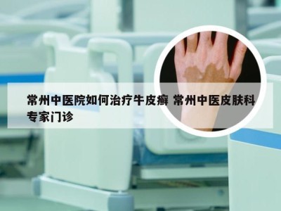 常州中医院如何治疗牛皮癣 常州中医皮肤科专家门诊