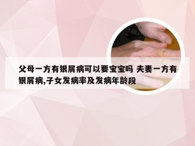 父母一方有银屑病可以要宝宝吗 夫妻一方有银屑病,子女发病率及发病年龄段