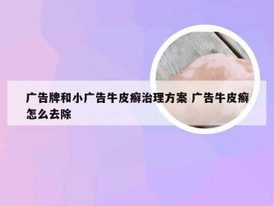 广告牌和小广告牛皮癣治理方案 广告牛皮癣怎么去除