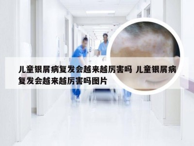 儿童银屑病复发会越来越厉害吗 儿童银屑病复发会越来越厉害吗图片