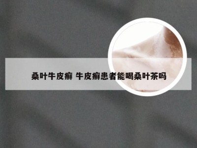 桑叶牛皮癣 牛皮癣患者能喝桑叶茶吗