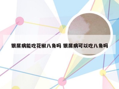 银屑病能吃花椒八角吗 银屑病可以吃八角吗