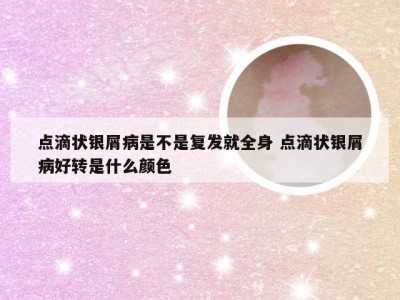 点滴状银屑病是不是复发就全身 点滴状银屑病好转是什么颜色