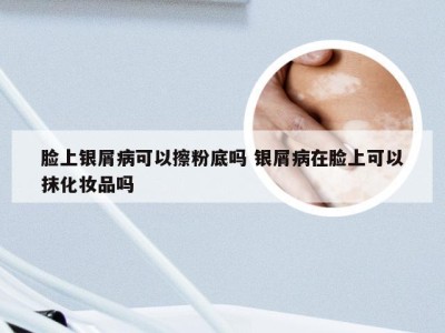 脸上银屑病可以擦粉底吗 银屑病在脸上可以抹化妆品吗