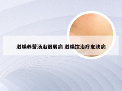 滋燥养营汤治银屑病 滋燥饮治疗皮肤病