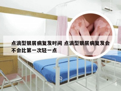 点滴型银屑病复发时间 点滴型银屑病复发会不会比第一次轻一点