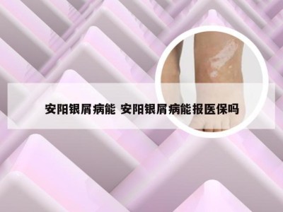 安阳银屑病能 安阳银屑病能报医保吗