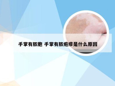 手掌有脓胞 手掌有脓疱疹是什么原因