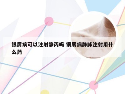 银屑病可以注射静丙吗 银屑病静脉注射用什么药