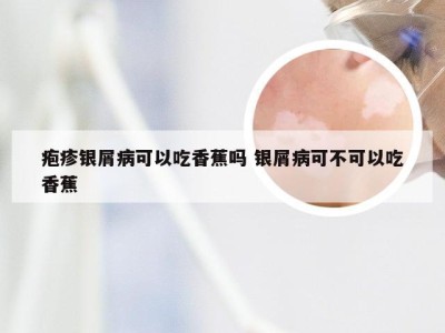 疱疹银屑病可以吃香蕉吗 银屑病可不可以吃香蕉
