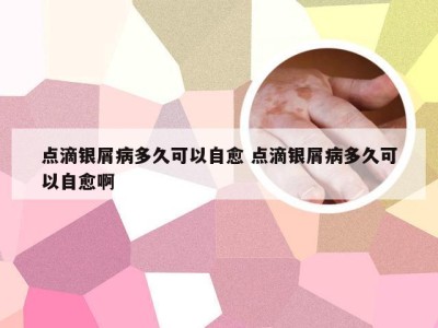 点滴银屑病多久可以自愈 点滴银屑病多久可以自愈啊