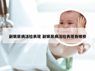 副银屑病活检表现 副银屑病活检表现有哪些