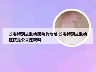 长春博润皮肤病医院的地址 长春博润皮肤病医院是公立医院吗