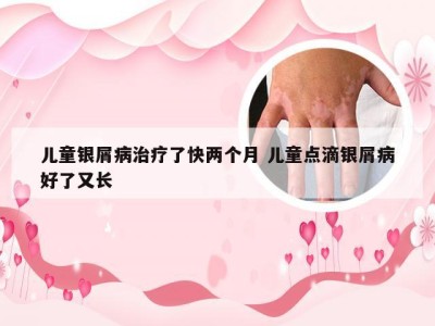 儿童银屑病治疗了快两个月 儿童点滴银屑病好了又长