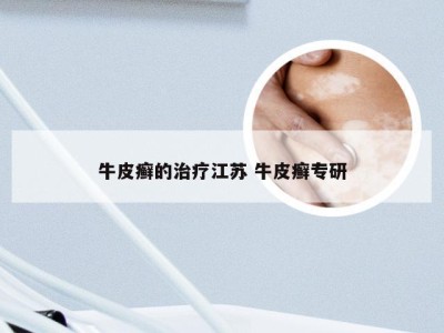 牛皮癣的治疗江苏 牛皮癣专研