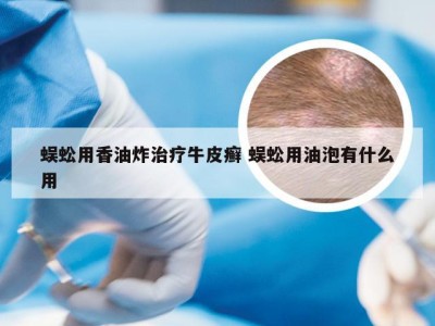 蜈蚣用香油炸治疗牛皮癣 蜈蚣用油泡有什么用
