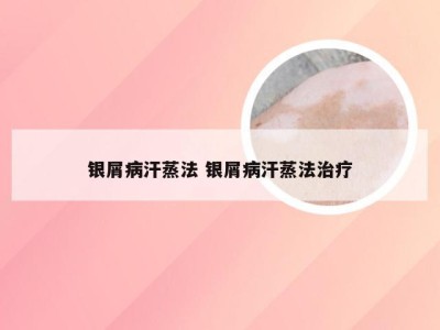 银屑病汗蒸法 银屑病汗蒸法治疗