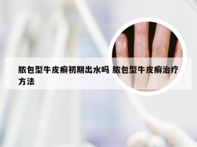 脓包型牛皮癣初期出水吗 脓包型牛皮癣治疗方法