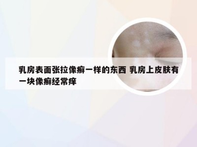 乳房表面张拉像癣一样的东西 乳房上皮肤有一块像癣经常痒